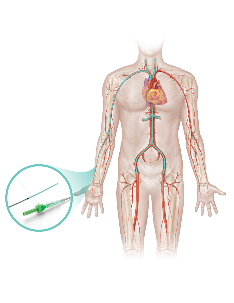 R2P Destination Slender product close-up and pathways through the human body